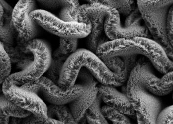 Stretchable supercapacitors to power tomorrow’s wearable devices
