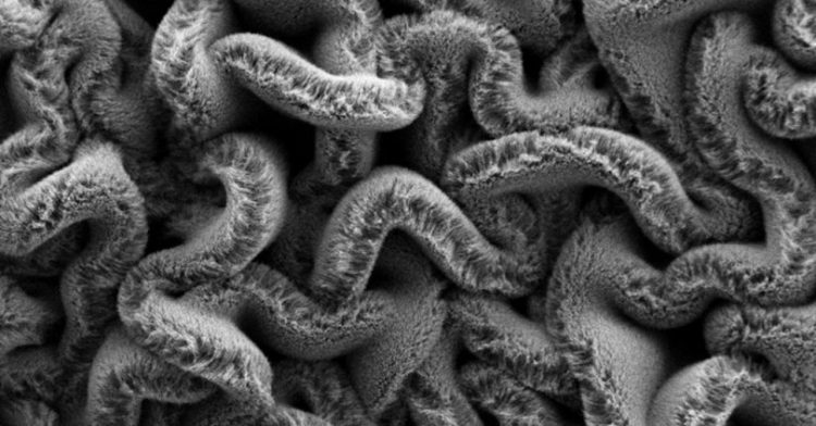 Stretchable supercapacitors to power tomorrow’s wearable devices